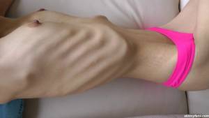 Nicoleta - anorexic skinny fragile mager duenn knochig bones 1-z7puiswelg.jpg