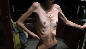 Nicoleta - anorexic skinny fragile mager duenn knochig bones 1-e7puimu0ao.jpg