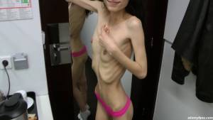 Nicoleta - anorexic skinny fragile mager duenn knochig bones 1-o7puitaxns.jpg