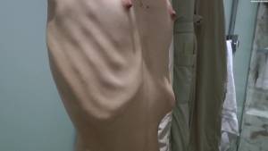 Nicoleta - anorexic skinny fragile mager duenn knochig bones 1-77puinfwnh.jpg