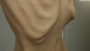 Nicoleta - anorexic skinny fragile mager duenn knochig bones 1-k7puitg0cx.jpg