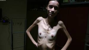 Nicoleta - anorexic skinny fragile mager duenn knochig bones 127puimxoyu.jpg