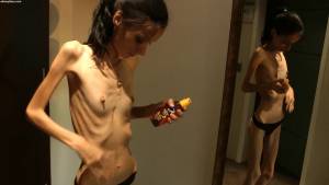 Nicoleta - anorexic skinny fragile mager duenn knochig bones 1-f7puimkg5s.jpg