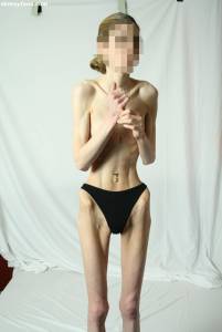 EXTREME Skinny Anorexic Janine 1-r7qdus5s7g.jpg