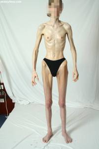 EXTREME Skinny Anorexic Janine 1-b7qdutomff.jpg