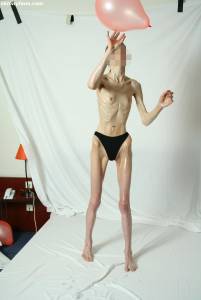 EXTREME Skinny Anorexic Janine 1-t7qduulq1d.jpg