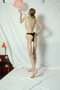 EXTREME Skinny Anorexic Janine 1-f7qduvdew5.jpg