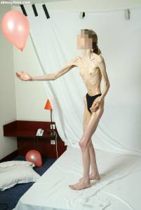 EXTREME Skinny Anorexic Janine 1-u7qduumyei.jpg