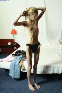 EXTREME Skinny Anorexic Janine 1c7qduo1djs.jpg