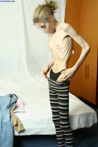 EXTREME Skinny Anorexic Janine 1s7qduntpcm.jpg