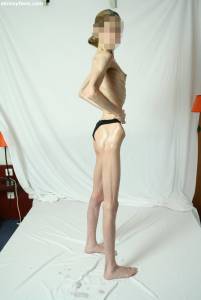 EXTREME Skinny Anorexic Janine 1-k7qduudqwb.jpg